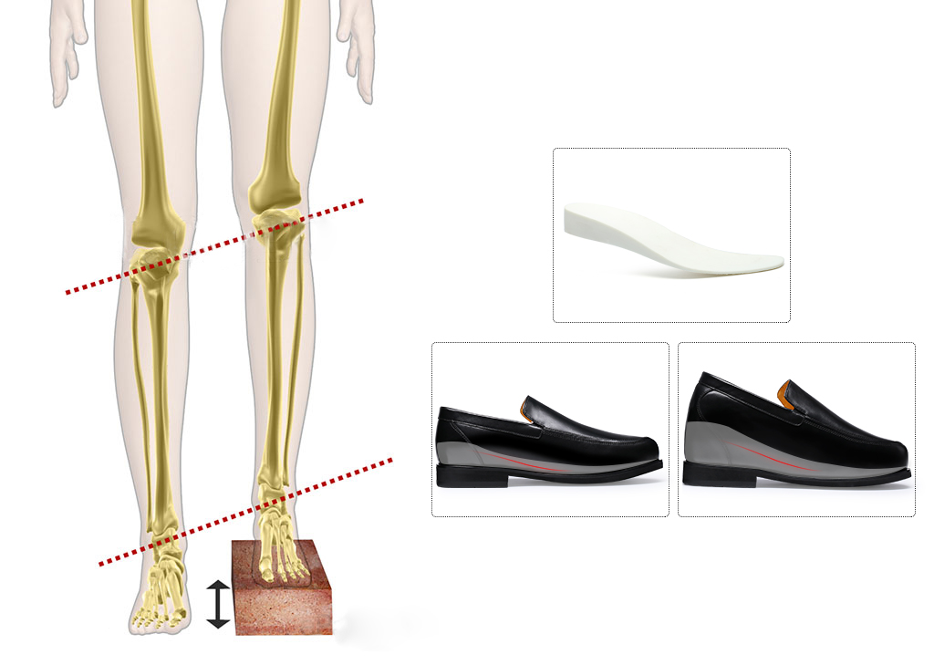 custom shoes for leg length discrepancy